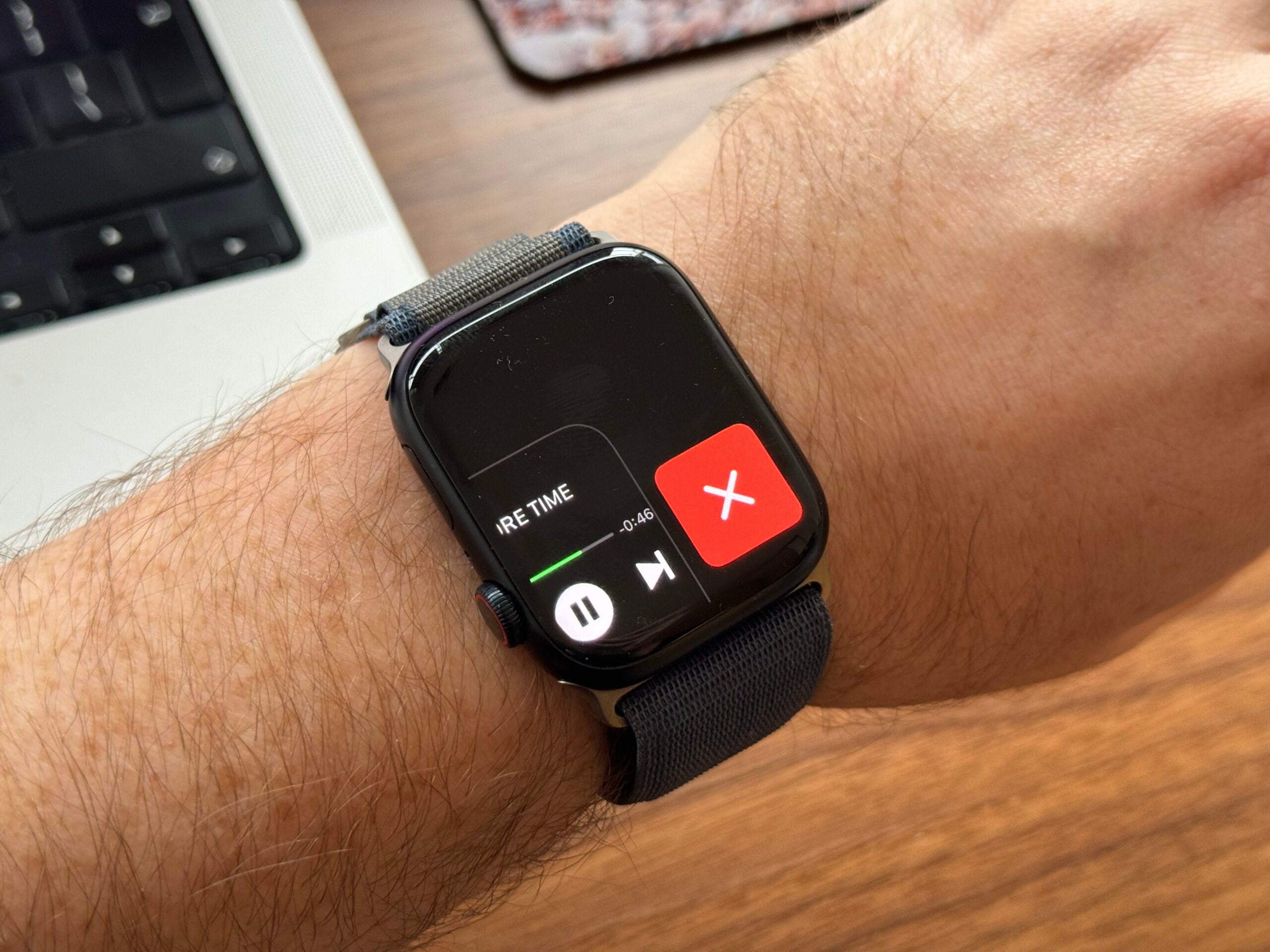 Tippen Sie auf das rote x auf der Apple Watch