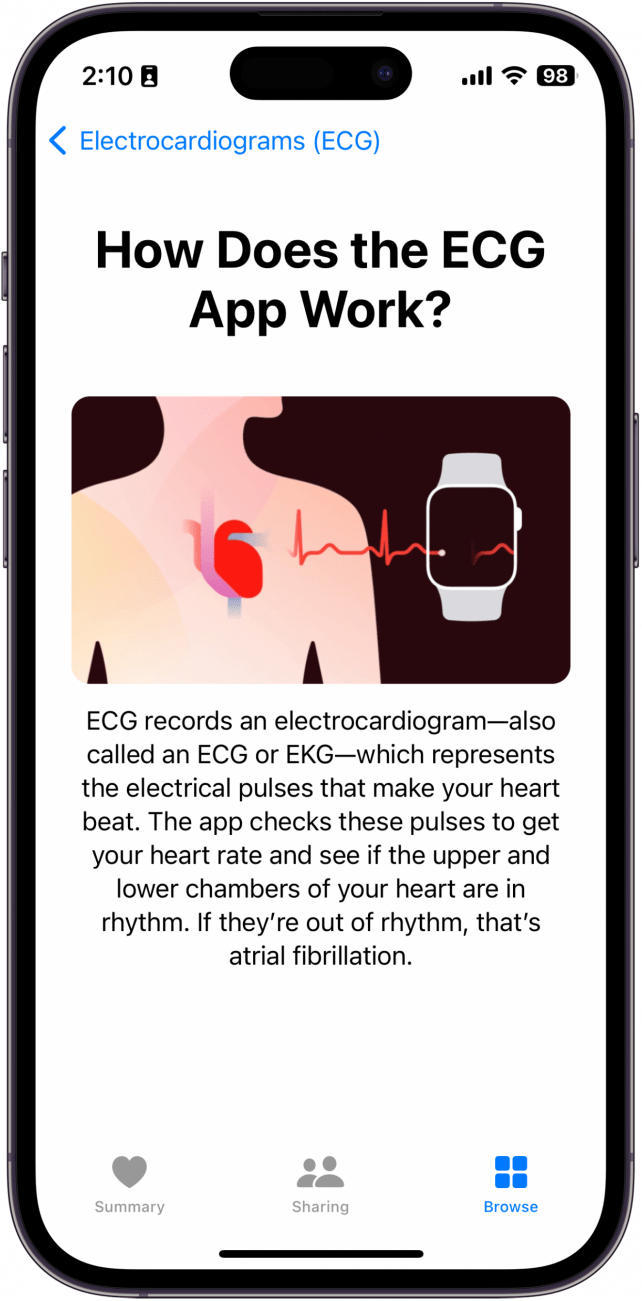EKG-Bildschirm der Apple Health App mit der Frage: 